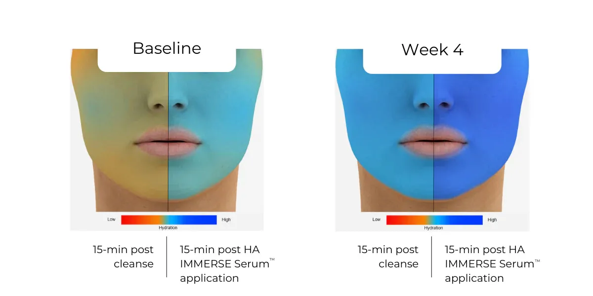 HA (Hyaluronic Acid) IMMERSE Serum™